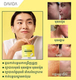 Davida vitamin - c toner pad - Cosmetic Product